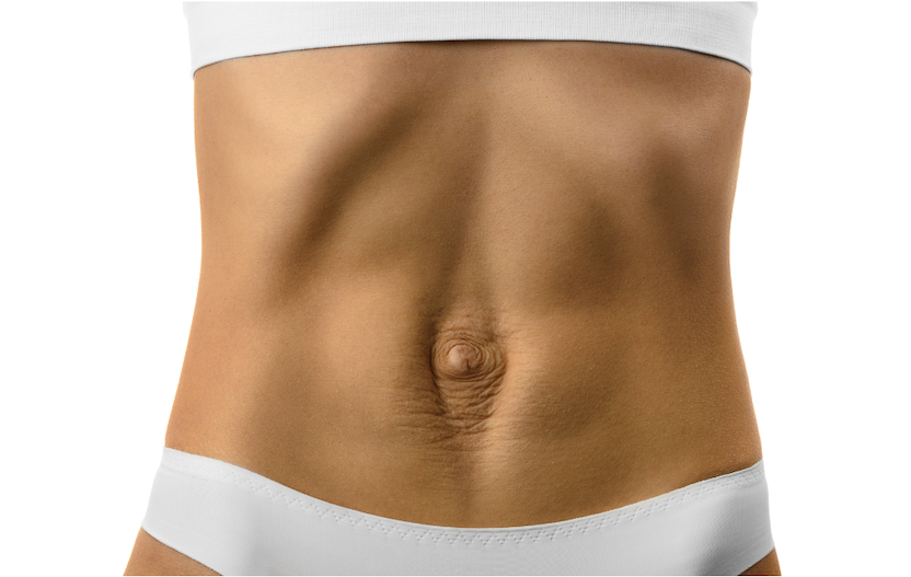 5 Myths And The Truth About Diastasis Recti